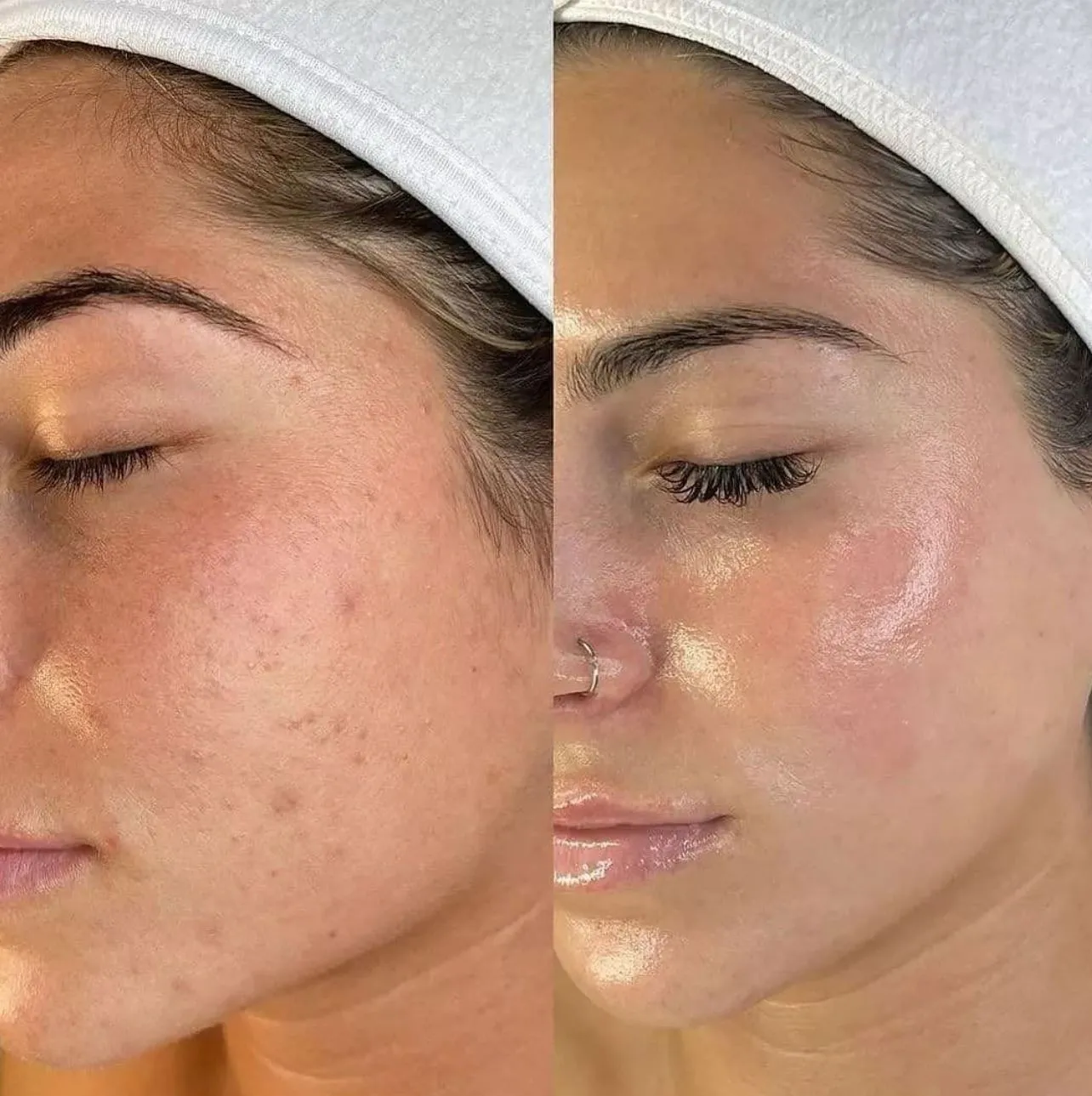 What’s a Fair Price for a Facial These Days?